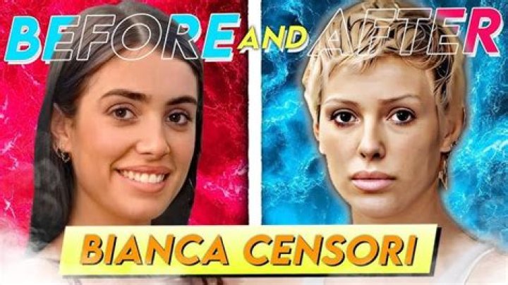 Bianca Censori Before Plastic Surgery: Her Journey and Transformation