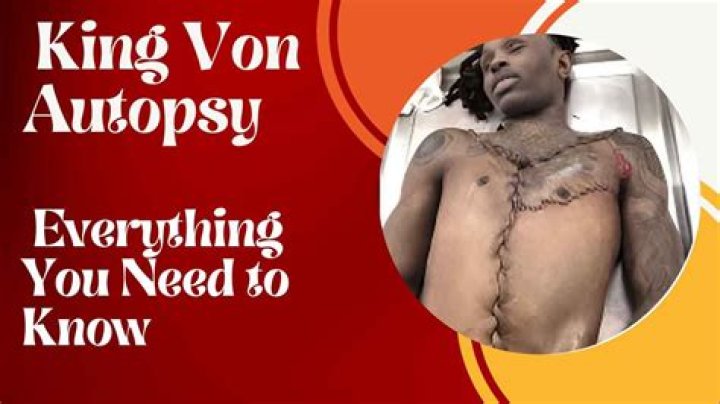 King Von Autopsy: Unveiling the Truth Behind a Tragic Loss